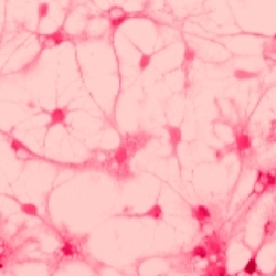 Neuron_blossoms_pink_preview